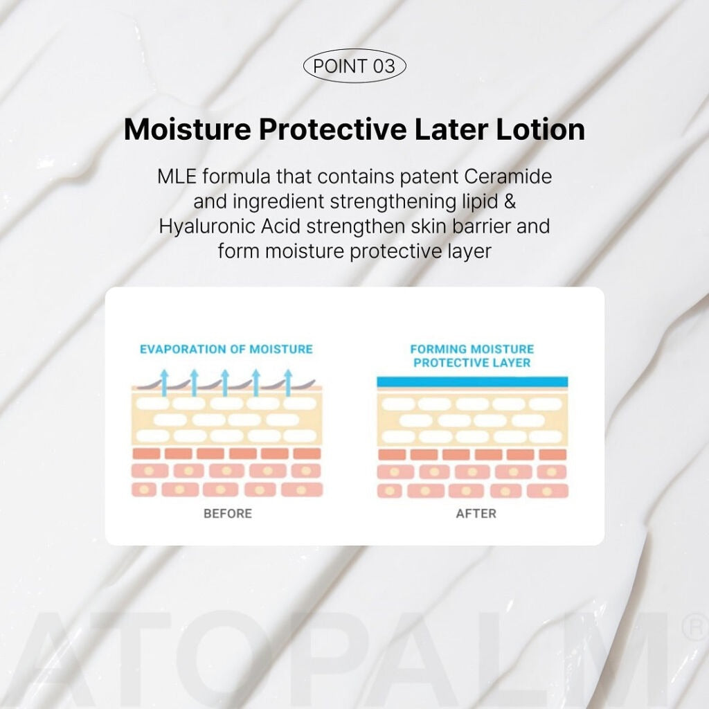 Atopalm MLE Lotion 120ml